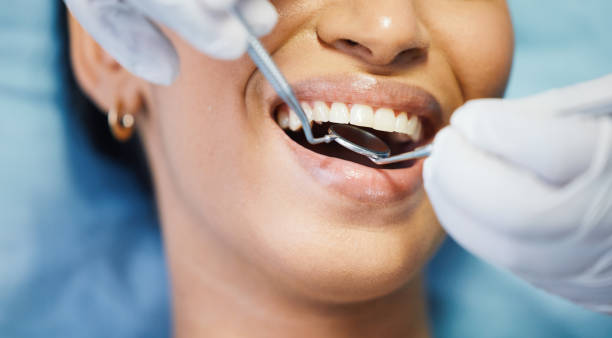 Best Broken Tooth Emergency  in Helotes, TX